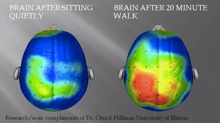 Brain scan after walking exercise