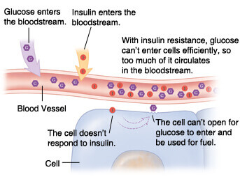 Unhealthy insulin response